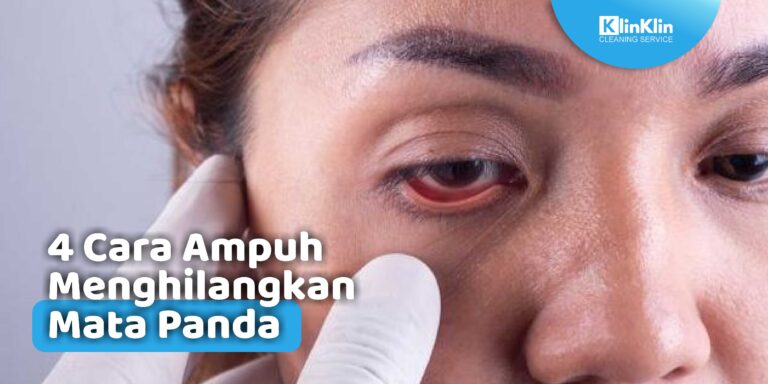 Cara Ampuh Menghilangkan Mata Panda