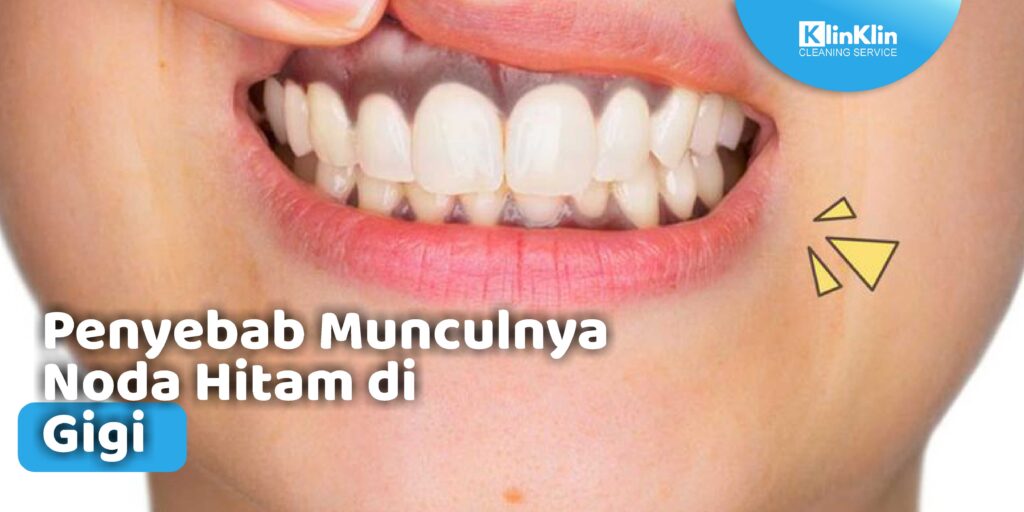 penyebab munculnya noda hitam di gigi